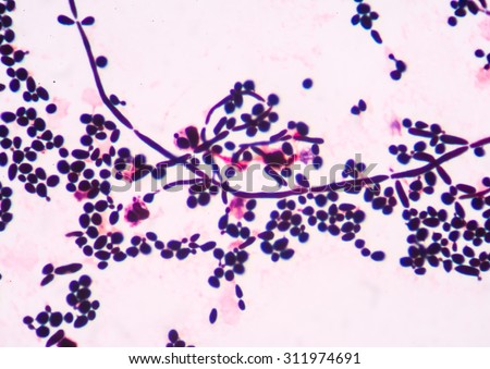 yeast microscope gram cells stain budding branching urine pseudohyphae fine under shutterstock eukaryote