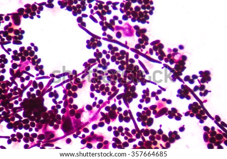 saccharomyces cerevisiae gram stain