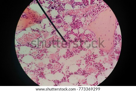 Thymus Gland Stock Images, Royalty-Free Images & Vectors | Shutterstock