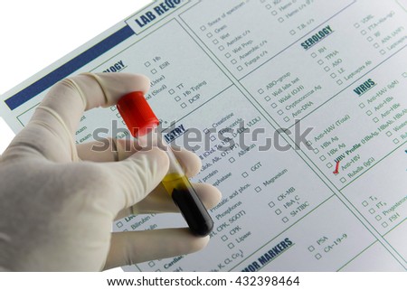 blood immunology A quantitative immunoglobulins (igs) test is used to determine immune system health and diagnose conditions such as recurrent infections, especially of the respiratory tract (sinus, lungs) or gastrointestinal tract (stomach, intestines), and/or chronic diarrhea. blood immunology A quantitative immunoglobulins (igs) test is used to determine immune system health and diagnose conditions such as recurrent infections, especially of the respiratory tract (sinus, lungs) or gastrointestinal tract (stomach, intestines), and/or chronic diarrhea.