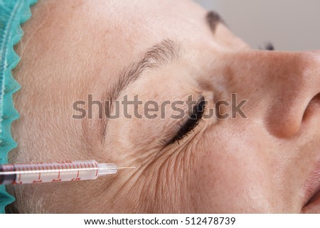 silicone injections facial contouring cam free live sex web