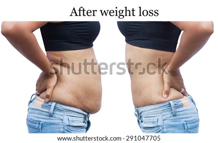 Hand Weight Loss Before And After