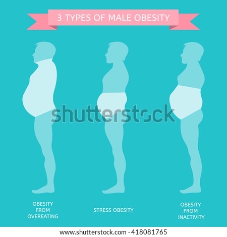 6 Types Obesity Male Female Figure Stock Vector 406066549 ...