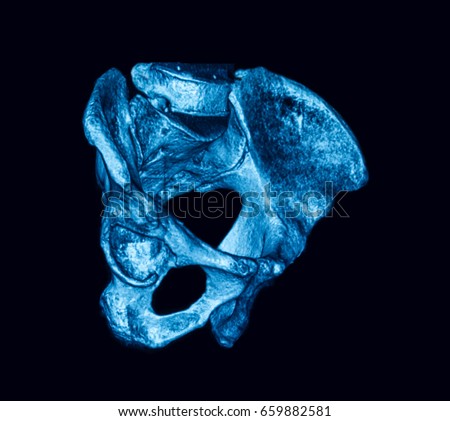 Pubic Bone Stock Images, Royalty-Free Images & Vectors | Shutterstock