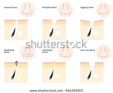 skin pores stock images royalty free images vectors pores stock images royalty free images vectors skin pores stock images royalty free images vectors pores stock images royalty free images vectors