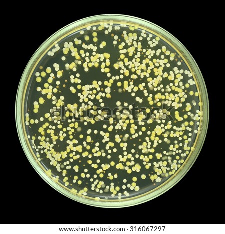 examination of bacterial plates Microscopic examination and bacterial culture of bile samples are common during diagnostic work-up of hepatobiliary disease in small animals1-4 aerobic and anaerobic culture plates had been ex-amined for bacterial growth frequency for up to 5 days. examination of bacterial plates Microscopic examination and bacterial culture of bile samples are common during diagnostic work-up of hepatobiliary disease in small animals1-4 aerobic and anaerobic culture plates had been ex-amined for bacterial growth frequency for up to 5 days.