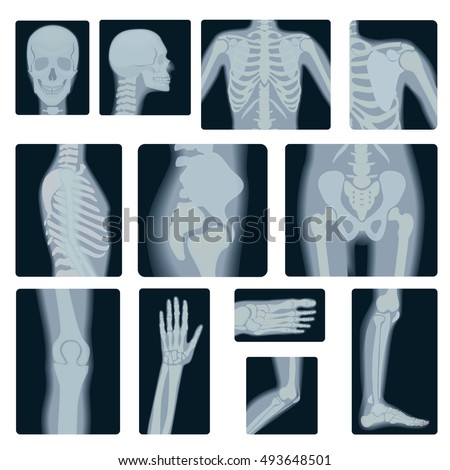 Картинки x ray