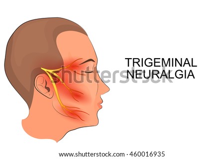 Trigeminal Stock Images, Royalty-Free Images & Vectors | Shutterstock