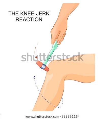 stock-vector-illustration-of-a-knee-reflex-in-neurology-589861154.jpg