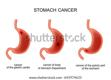 Stomach Anatomy Diagram Human Digestive Organ Stock Illustration ...