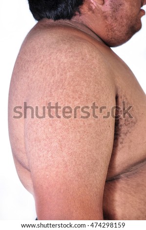 pigmentation asian skin viewer sharing adult video