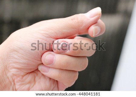 amiture bondage thumbs h l ne joy nude