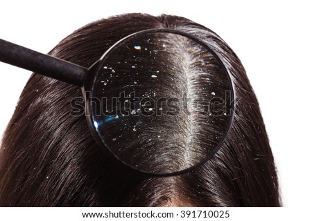 Dandruff Stock Images, Royalty-Free Images & Vectors 