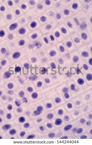 Root Tip Onion Mitosis Cell Root Stock Photo 544244044 ...