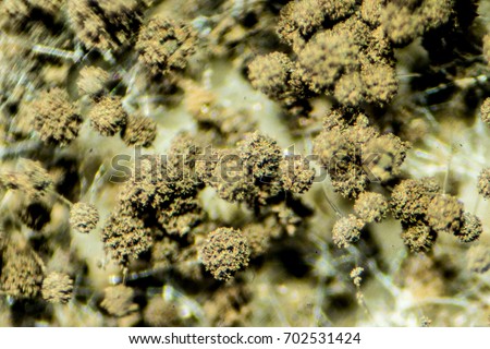 Aspergillus Mold Under Stereo Microscope View Stock Photo ...