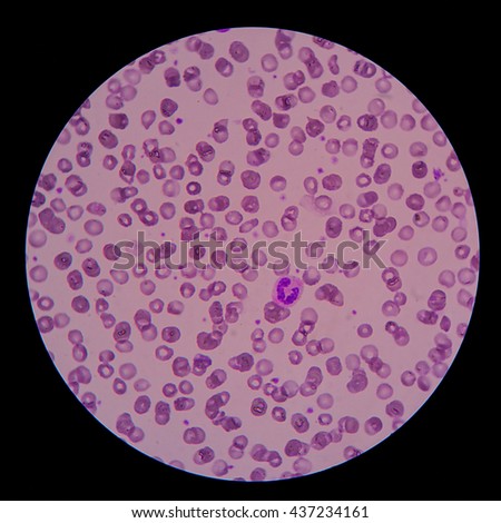 Neutrophil Stock Photos, Royalty-Free Images & Vectors - Shutterstock