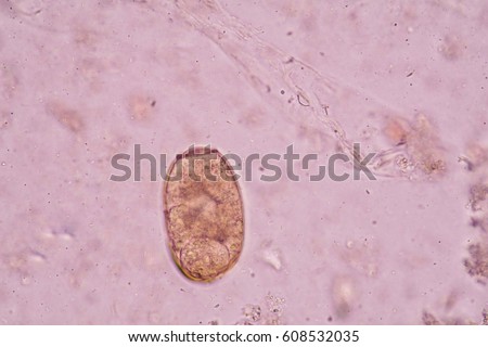 Liver Fluke Stock Images, Royalty-Free Images & Vectors | Shutterstock