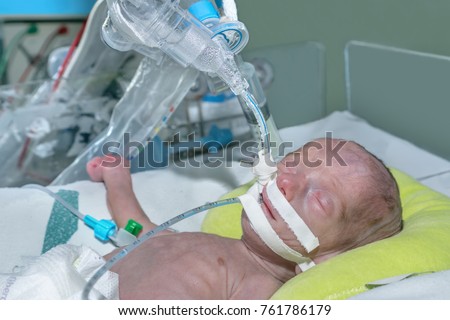 Intubation Stock Images, Royalty-Free Images & Vectors | Shutterstock