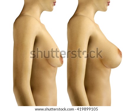 Have hit enlarging mens breast you have Consider, that enlarging mens breast
