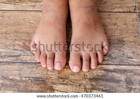 Cambodian Girl Fucked Asian Women Toes