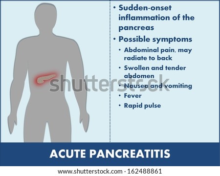 Acute Pancreatitis Disease Information Stock Illustration 162488861 ...