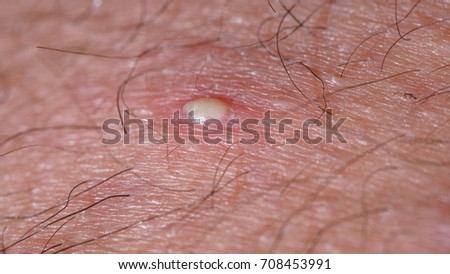 Excrescences Stock Images, Royalty-Free Images & Vectors ...