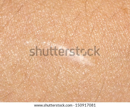 macro scar on the human skin stock photo image 61059545 skin scar stock images royalty free images vectors macro scar on the human skin stock photo image 61059545 skin scar stock images royalty free images vectors