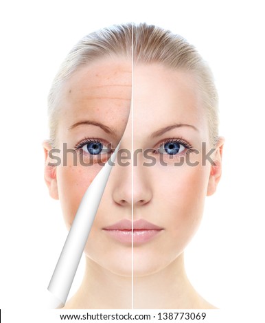 Beautiful woman's portrait isolated on white, before and after retouch, skin care.