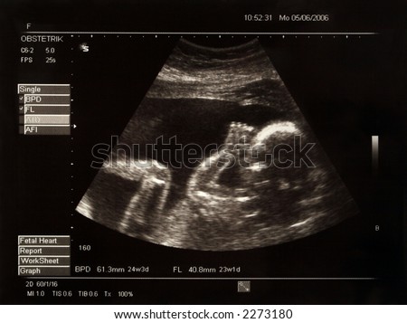 Ultrasound Baby Stock Images, Royalty-Free Images & Vectors | Shutterstock