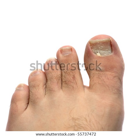 Smelly feet Stock Photos, Images, & Pictures | Shutterstock