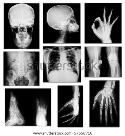 X-ray Stock Images, Royalty-Free Images & Vectors | Shutterstock