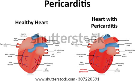 Pericardium Stock Images, Royalty-Free Images & Vectors | Shutterstock