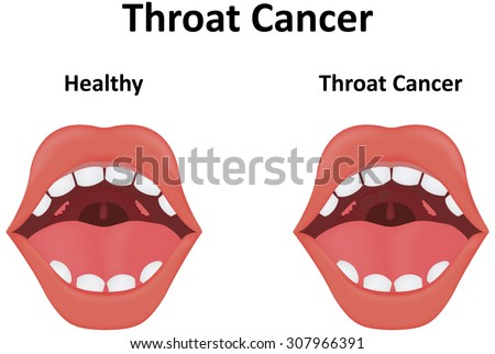 Visual Pronunciation Guide Mouth Showing Correct Stock Vector 491364739