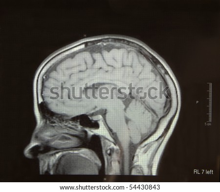 Brain Scan Stock Photos, Images, & Pictures | Shutterstock