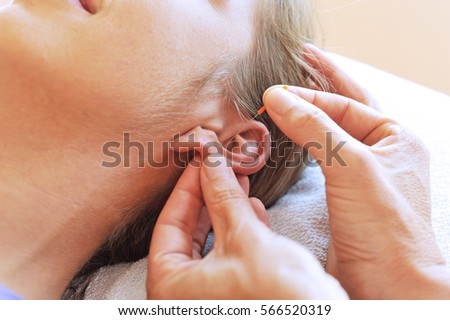 Woman receiving acupuncture on her ear