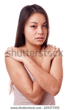 Why is fisting bad Asian self picture