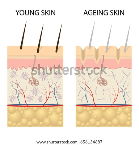 Young Healthy Skin Older Skin Comparison Stock Vector 656134687 ...