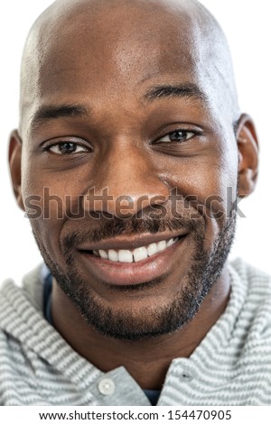 Man With Black Eye Stock Photos, Images, & Pictures | Shutterstock