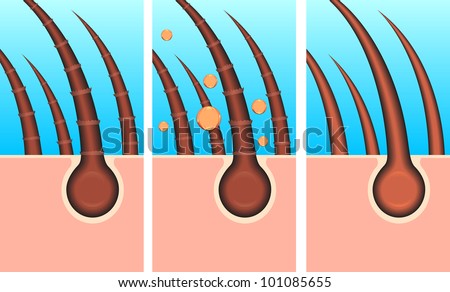 skin pores stock images royalty free images vectors skin pores stock images royalty free images vectors skin pores stock images royalty free images vectors skin pores stock images royalty free images vectors