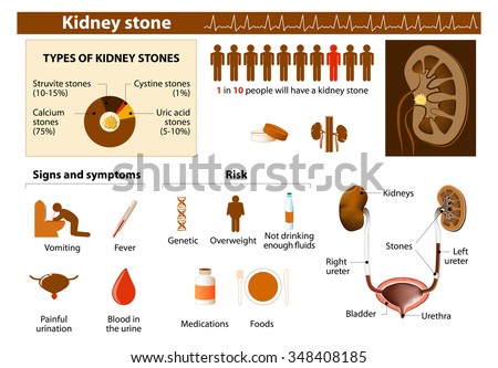 Diet For Kidney Stones Handout Template