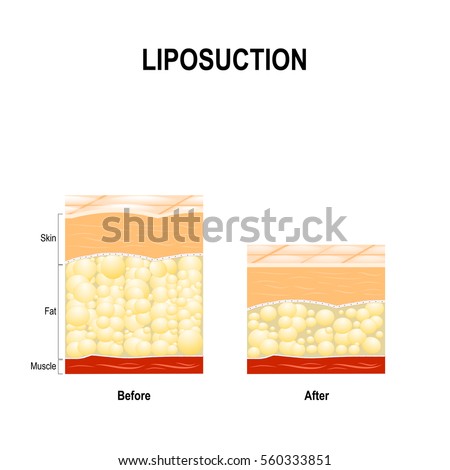 Ayurvedic medicine for loss fat image 8