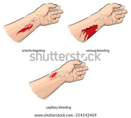 Bleed Stock Images, Royalty-Free Images & Vectors | Shutterstock