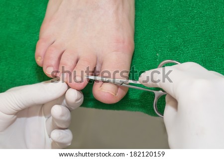 quá trình chân tại thẩm mỹ viện