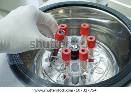 blood centrifuge serum separate red tube technician add cells shutterstock search process preview