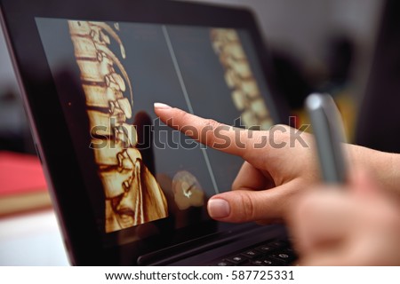 Hand pointing on screen with X-rays of the spine. close up