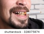 Bad Teeth Smoker Sick