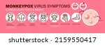 Monkeypox Virus Symptoms. New...