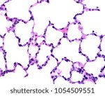 Small photo of High magnification micrograph showing the typical aspect of the lung parenchyma with many alveoli of very thin walls.