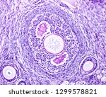 Small photo of Ovary stained with the periodic acid of Schiff (PAS) method. The zona pellucida appear stained by PAS due to its glycoprotein nature. The antrum liquid is also PAS positive.