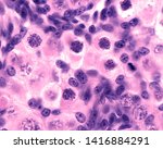Small photo of Fetal ovary. Oocyte meiosis. Micrograph showing several oocytes in leptotene stage. In this stage of prophase I, individual chromosomes form visible thin strands within the nucleus.
